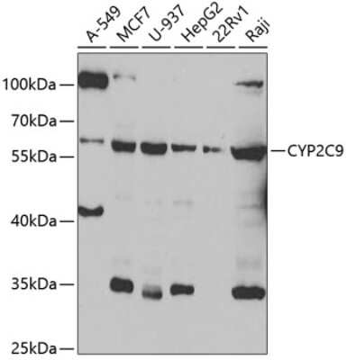 Western Blot: Cytochrome P450 2C9 Antibody [NBP2-92898] - Western blot analysis of extracts of various cell lines, using Cytochrome P450 2C9 antibody (NBP2-92898) at 1:1000 dilution._Secondary antibody: HRP Goat Anti-Rabbit IgG (H+L) at 1:10000 dilution._Lysates/proteins: 25ug per lane._Blocking buffer: 3% nonfat dry milk in TBST._Detection: ECL Enhanced Kit._Exposure time: 10s.